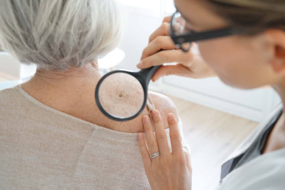 dermatologist checking the skin of old woman