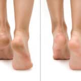 Tips and Tricks How to Remove Dead Skin from Your Feet? Tips and Tricks