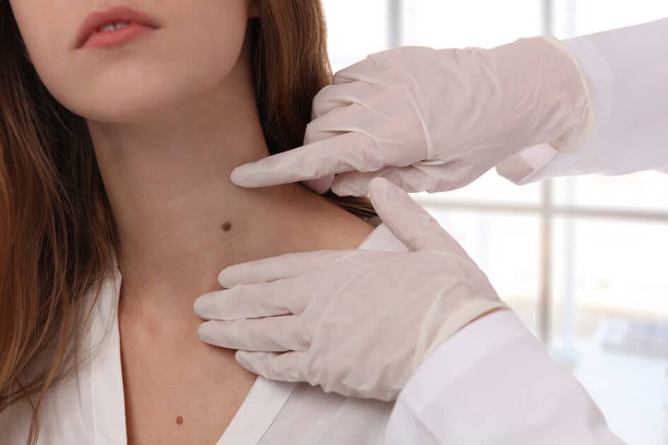dermatologist checking up a patient skin tags