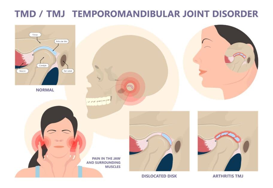 different picture of TMJ disorder
